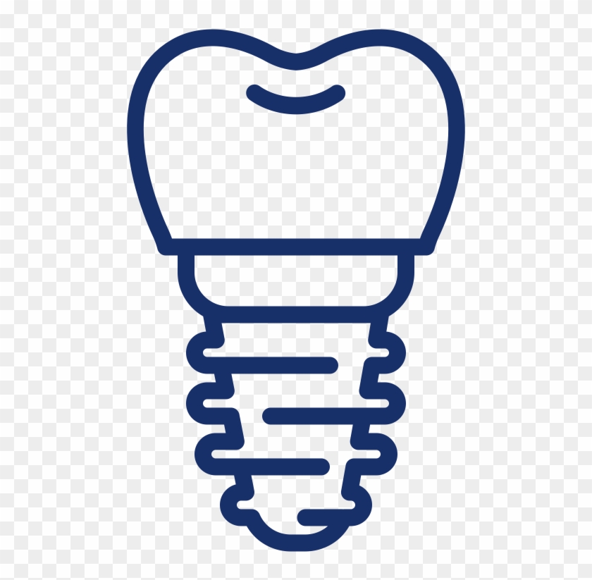 Dental Implants Afinia A Implant Has Three - Dental Implants Afinia A Implant Has Three #1481925