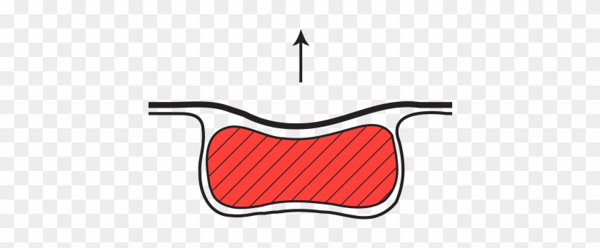 Complete Protection Against Any Spoilage - Complete Protection Against Any Spoilage #1495164