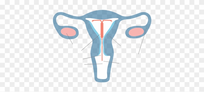 Interactive Uterus - Interactive Uterus #1517847