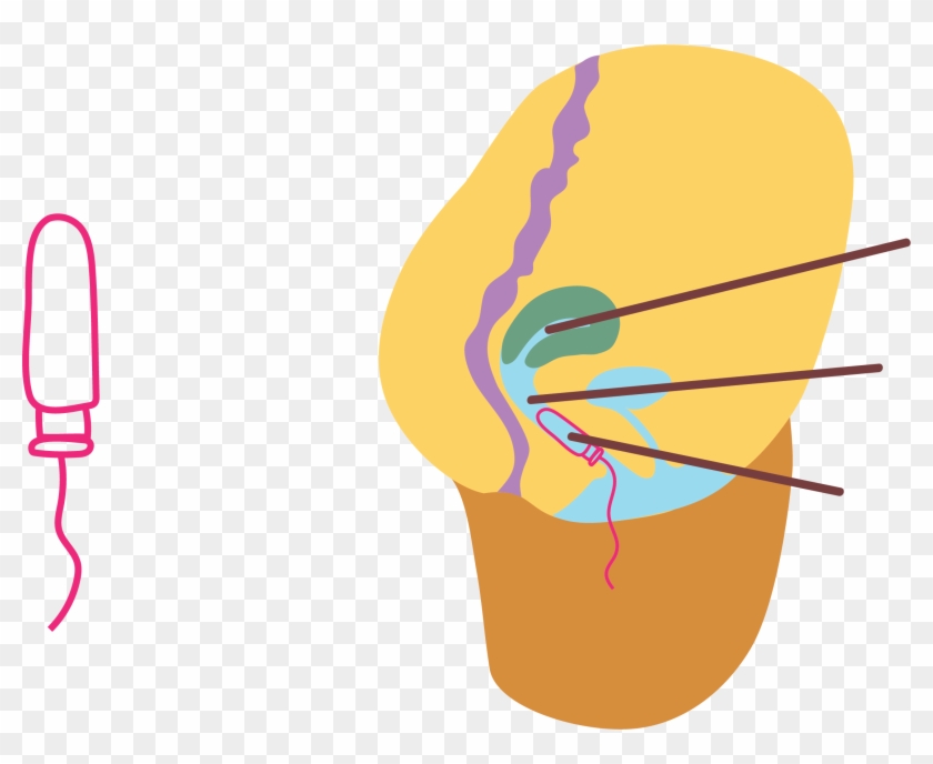 Uterus - Uterus #1517861