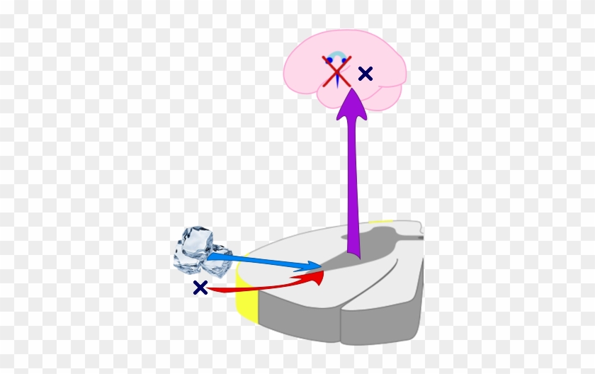 Heat At The Trigger Point Eliminates Pain And Brings - Heat At The Trigger Point Eliminates Pain And Brings #1518103