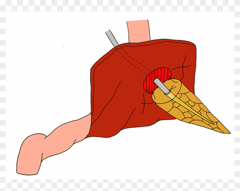 References - References #1524944