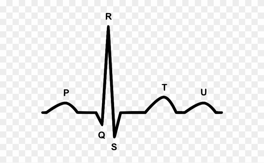 Ecg Waveform - Promedcert - Ecg Waveform - Promedcert #1529374