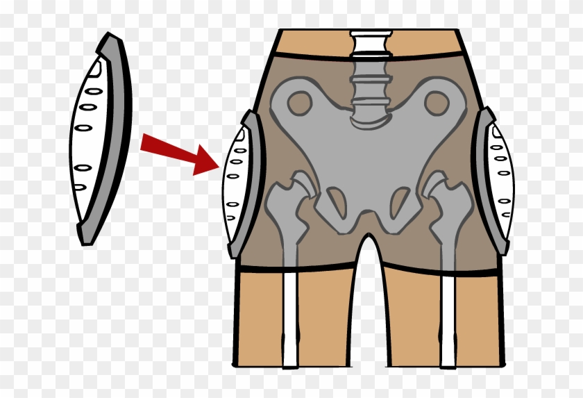 Hip Protectors Are Commonly Used By Seniors Who Have - Hip Protectors Are Commonly Used By Seniors Who Have #1531628