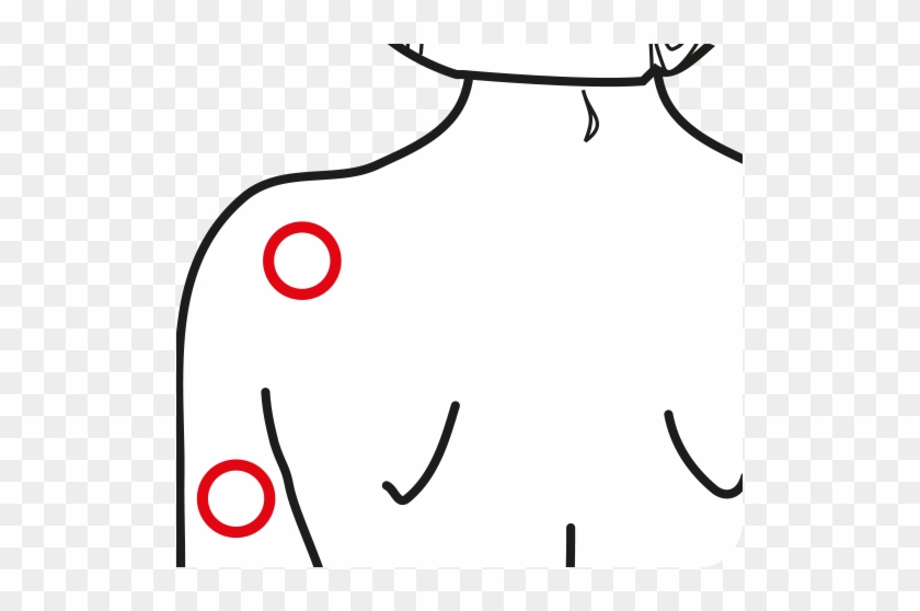 Muscular Pathologies Of The Rotor Cuff And The Brachial - Muscular Pathologies Of The Rotor Cuff And The Brachial #1531640