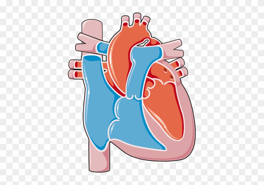 Congenital Heart Diseases Coarctation Of The Aorta - Congenital Heart Diseases Coarctation Of The Aorta #1534874