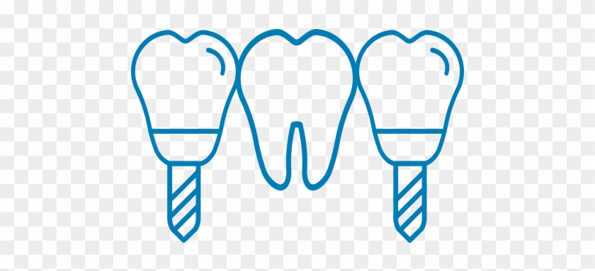 Dental Bridges Available At Straford Dental Office - Dental Bridges Available At Straford Dental Office #1538149