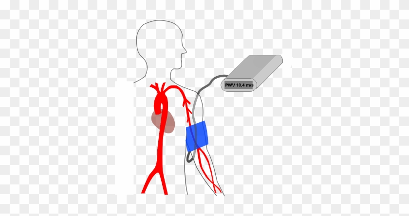 Determination Of Arterial Stiffness - Determination Of Arterial Stiffness #1552538