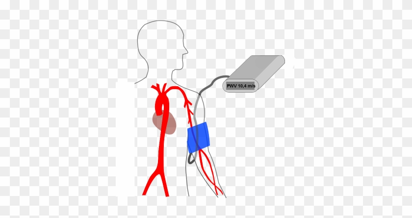 Determination Of Arterial Stiffness - Determination Of Arterial Stiffness #1552538