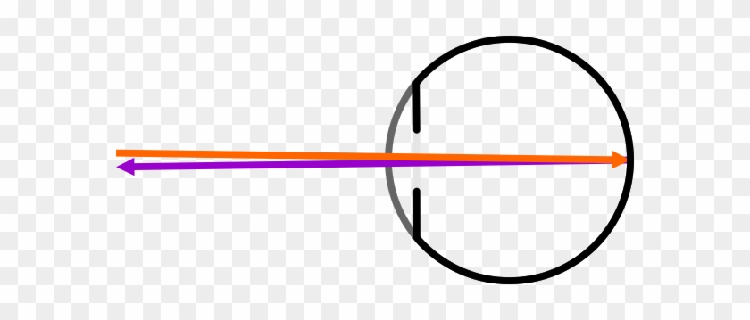 Enter Image Description Here - Enter Image Description Here #1560371