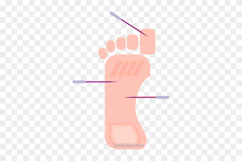 Acupuncture Royalty Free Vector Clip Art Illustration - Acupuncture Royalty Free Vector Clip Art Illustration #1562417
