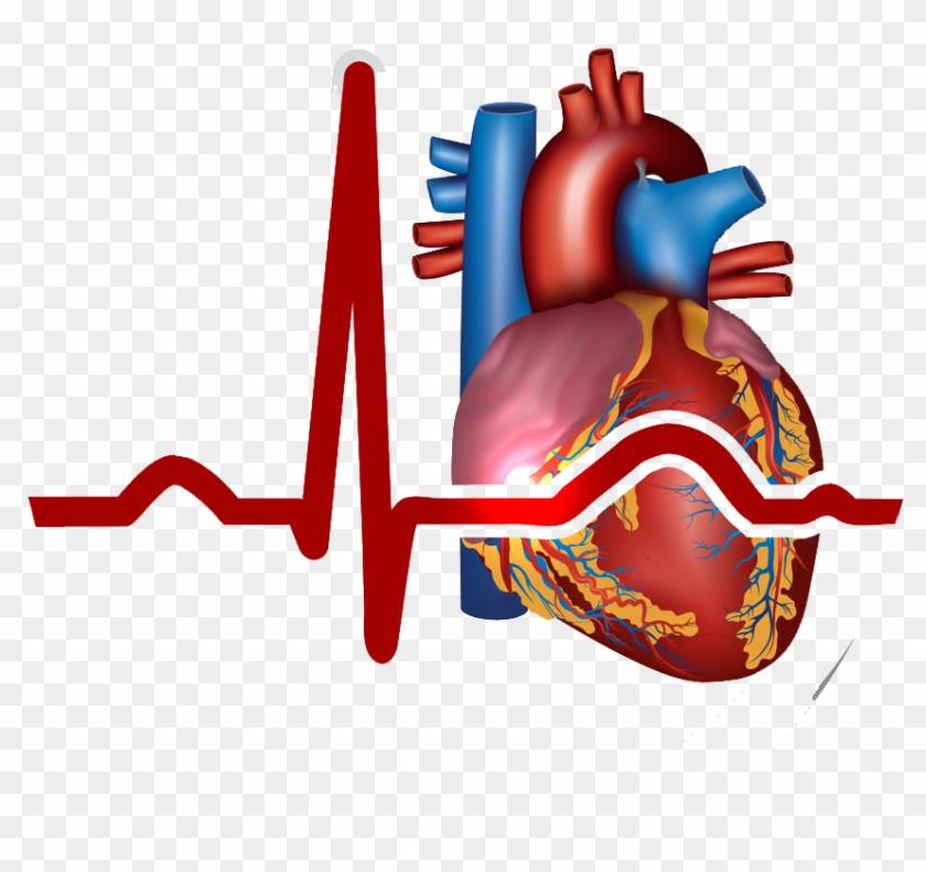Myocardial Infarction Heart Cardiovascular - Myocardial Infarction Heart Cardiovascular #1566933