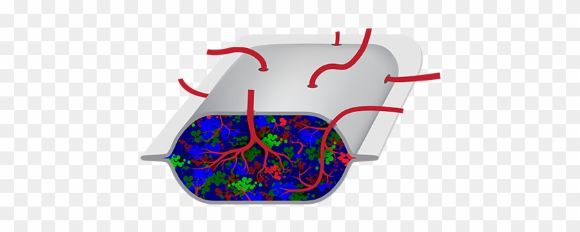 Viacyte Advances Cell Replacement Therapy For High - Viacyte Advances Cell Replacement Therapy For High #1572369