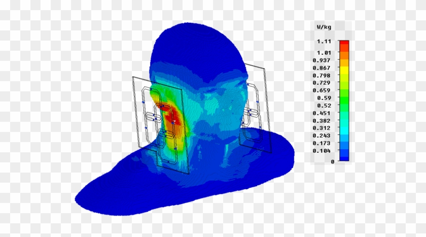 The Primary Concern Is That The Rf Electromagnetic - The Primary Concern Is That The Rf Electromagnetic #1576599