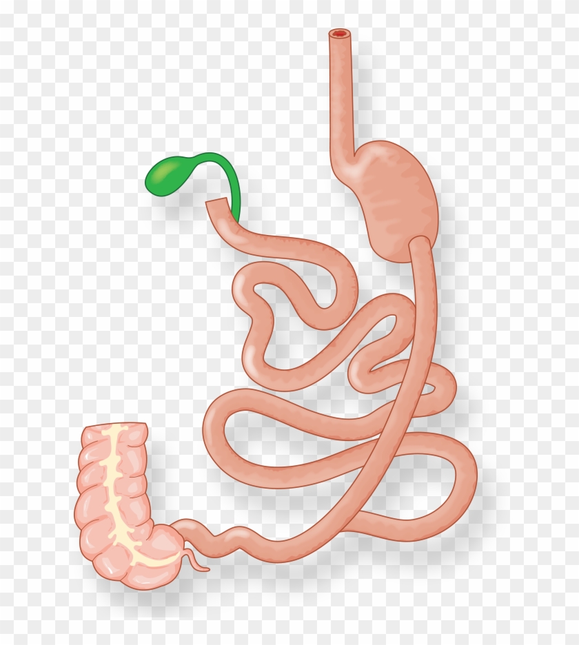 Illustration Of Intestines And Stomach After Duodenal - Illustration Of Intestines And Stomach After Duodenal #1581446