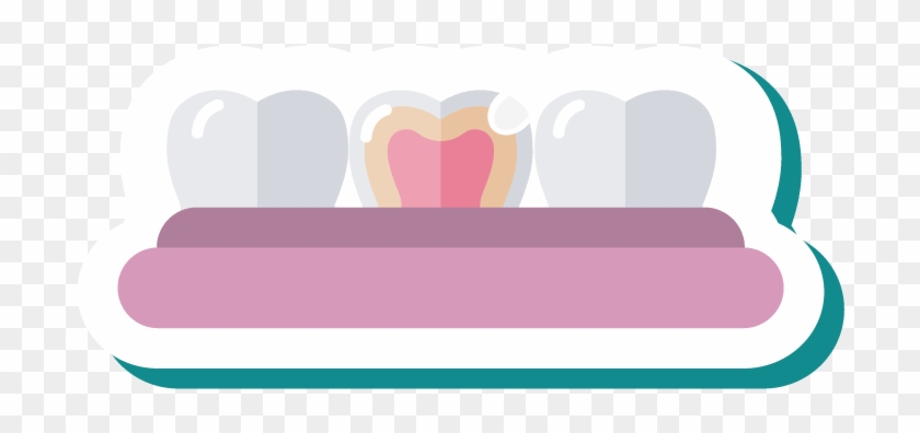 Fillings - Fillings #1582519