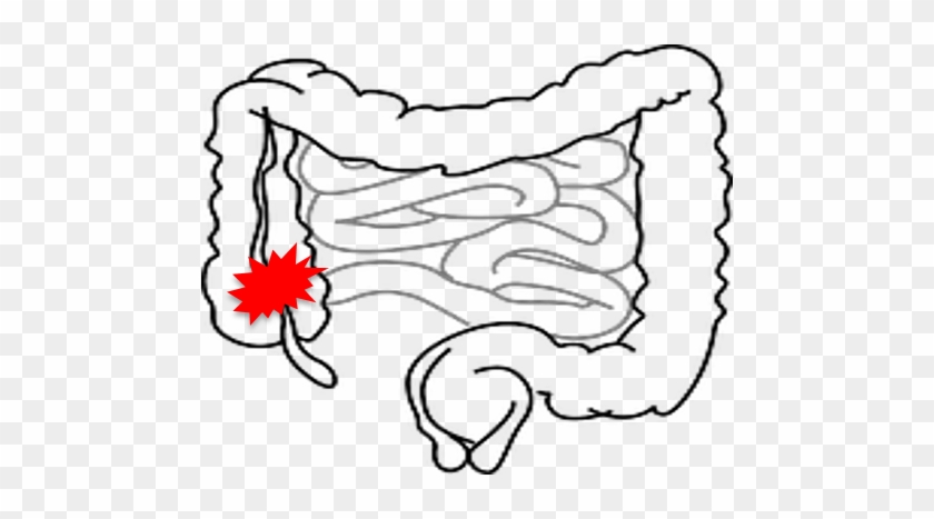 You Are Here - Intestines Clipart #1589017