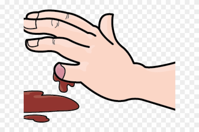 Wound Clipart Bleeding Kansas - Amputation Finger Clipart - Free Transparen...