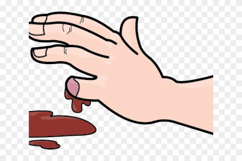 Wound Clipart Bleeding Kansas - Amputation Finger Clipart #1601902