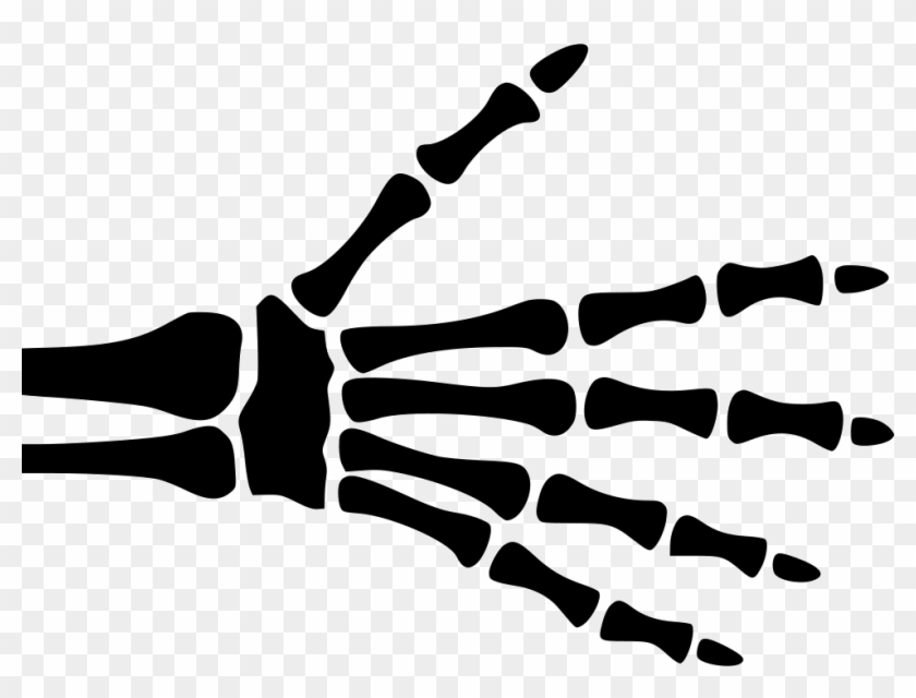 Hand Skeleton Comments - Png Hand X Ray #1603302