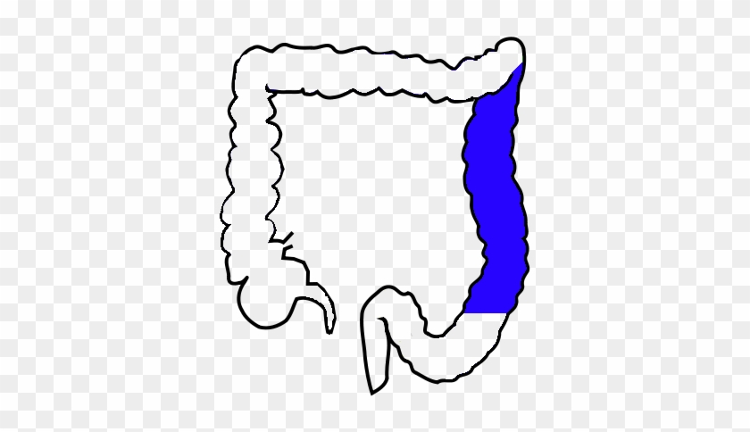 Descending Colon - Colon Transversum #1608034