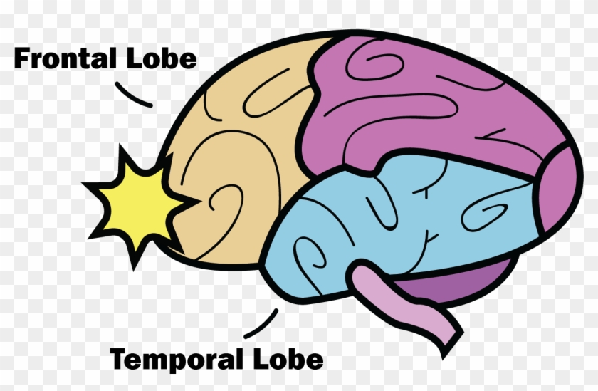 The Anatomy Of A Concussion - Concussion Frontal And Temporal Lobe #1613387