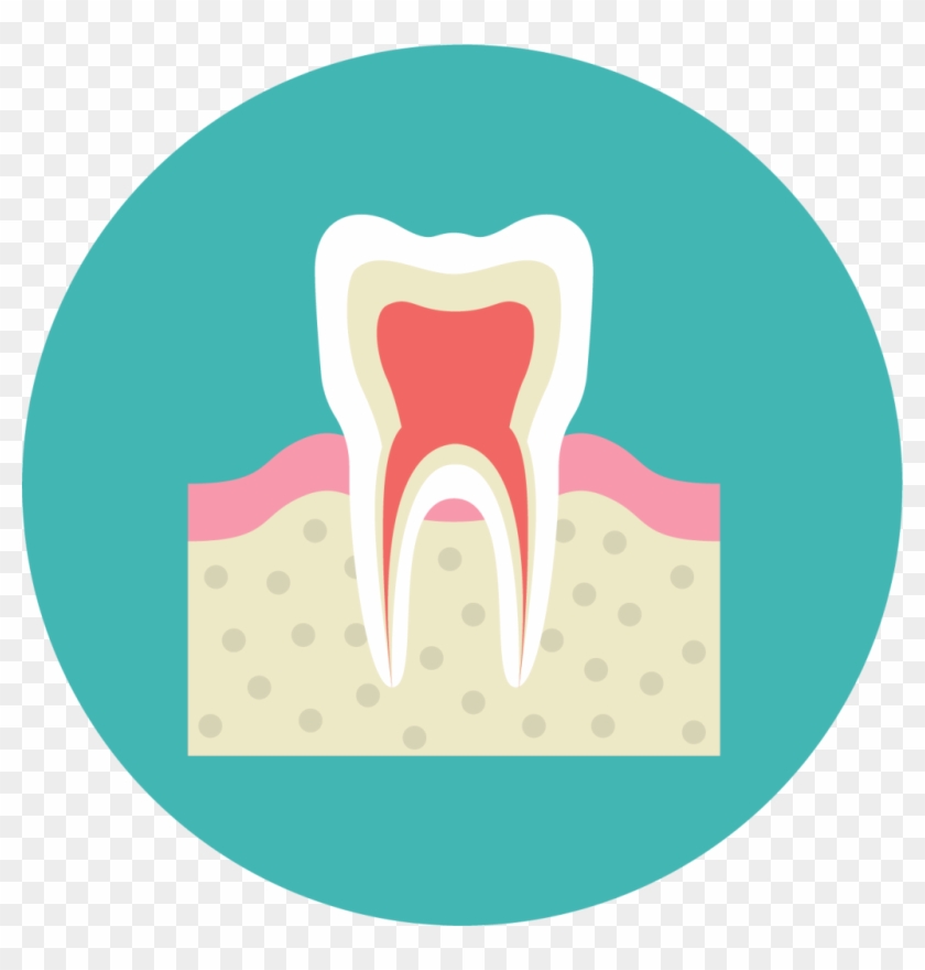 Root Canal - - Root Canal - #1619152