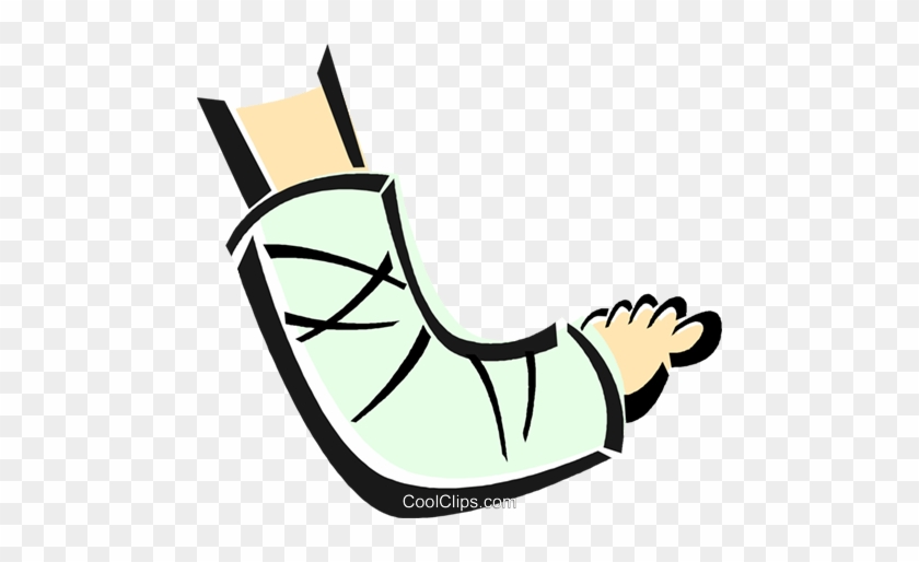 Arm Cast Cliparts - Broken Arm Clip Art #1631748