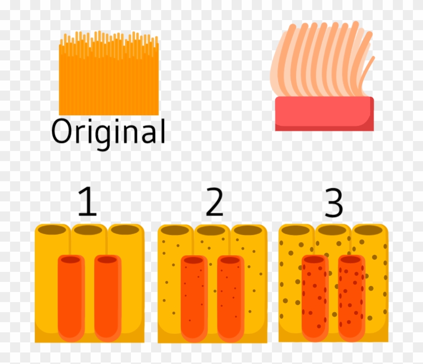 Flair Neededanemone Reskin Sponge Variation Second - Flair Neededanemone Reskin Sponge Variation Second #1633739