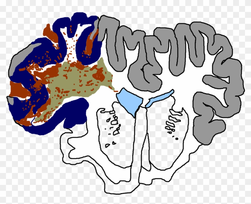 Traumatic Injury Cosbid Co Operative Studies On - Illustration #1640212