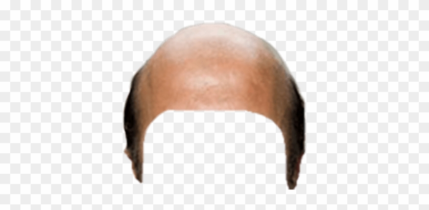 Head Clipart 0 - Bald Head No Background #1676526