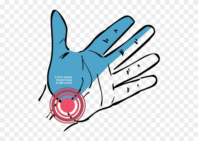 Tunnel Clipart Transparent - Carpal Tunnel Syndrome Transparent Background #1682848