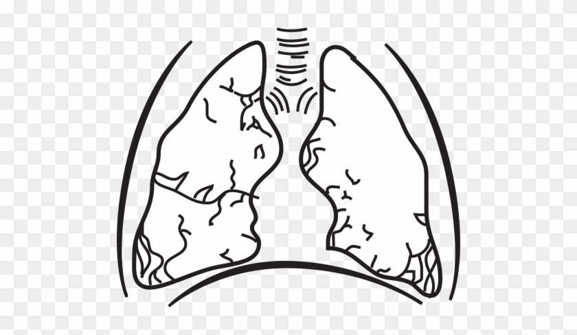 Vector Graphics - Plain Lungs #1694707