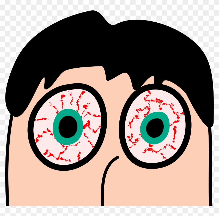 Tired Clipart Sleepless - Cartoon With Red Eyes #261865