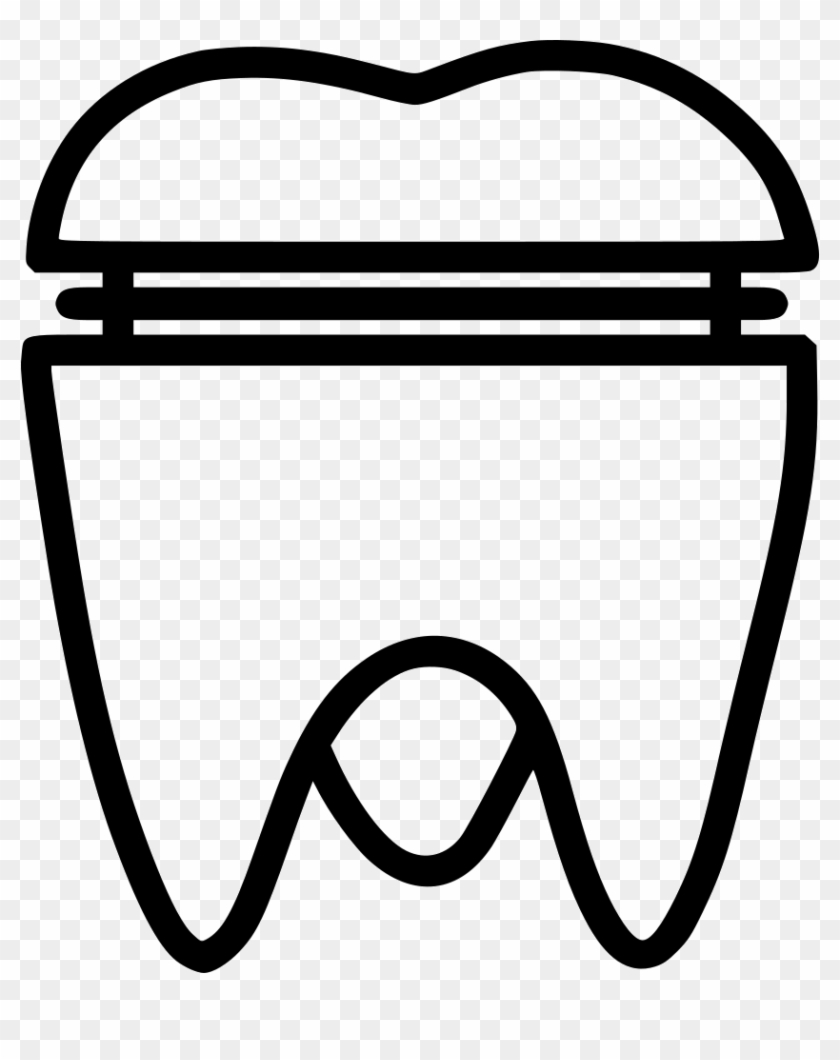 Molar Crown Svg Png Icon Free Download - Dentistry #1718178