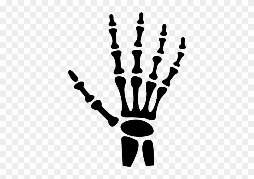 Bone Parts Hands Human People Hand Bones - Skeleton Hand Svg #1727248