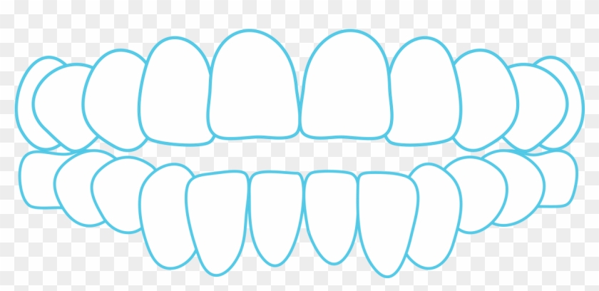 Clear Aligner System Open - Circle #1750397