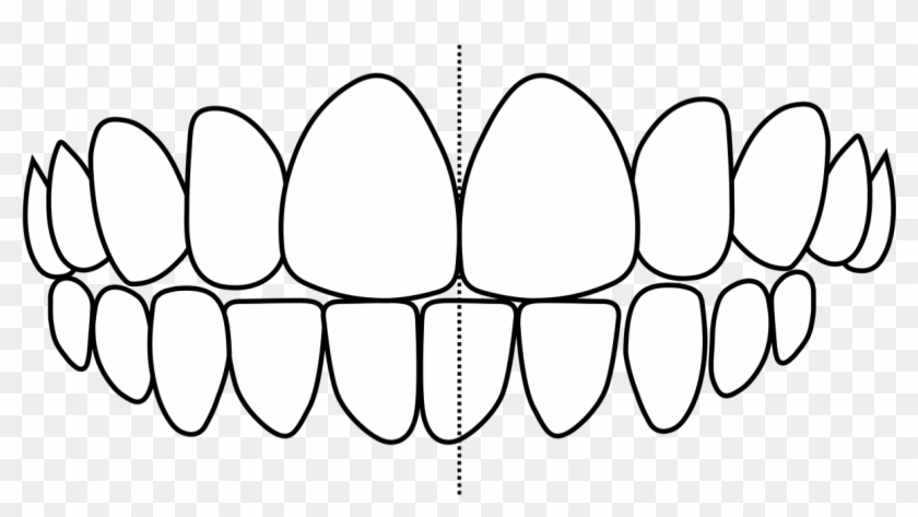 Crooked Teeth - Crooked Teeth #1753405