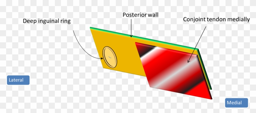 Surgical Anatomy Of Canal World Surgery Forum - Flap Valve Mechanism Of Inguinal Canal #1756640