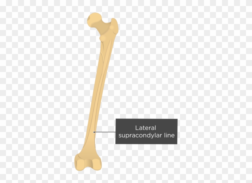 Lateral Supracondylar Line - Lateral Supracondylar Line Of Femur #1757231