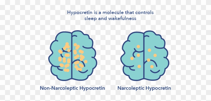 Narcoleptic Hypocretien Vs - Hypocretin Narcolepsy #1759846