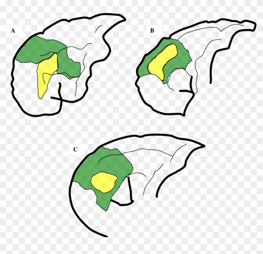 Comparison Of Approximate Locations Of Areas 9 And - Comparison Of Approximate Locations Of Areas 9 And #1761709