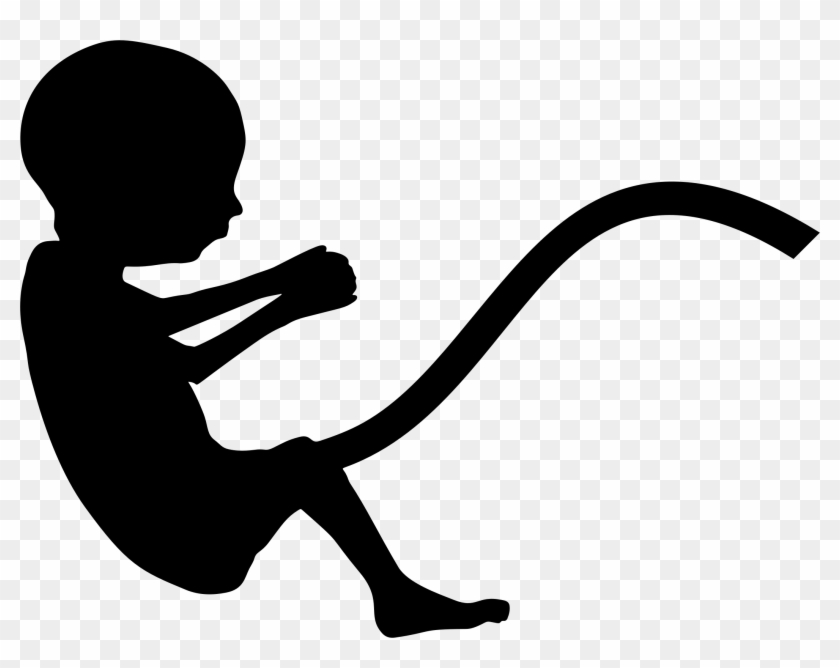 Fetus Infant Uterus Pregnancy Mother - Fetus Silhouette #301174