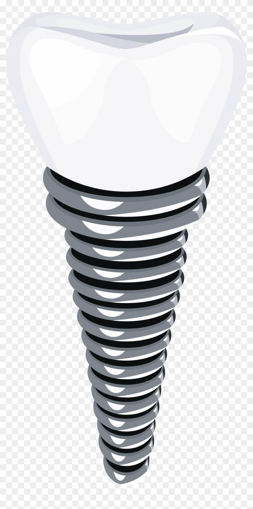 Dental Implant Png Clip Art - Dental Implant Clip Art #320115