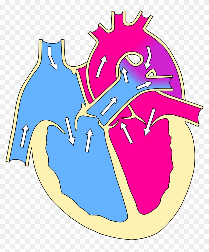 Real Heart Cartoon 24, Buy Clip Art - Acyanotic Vs Cyanotic Heart Defects #323211