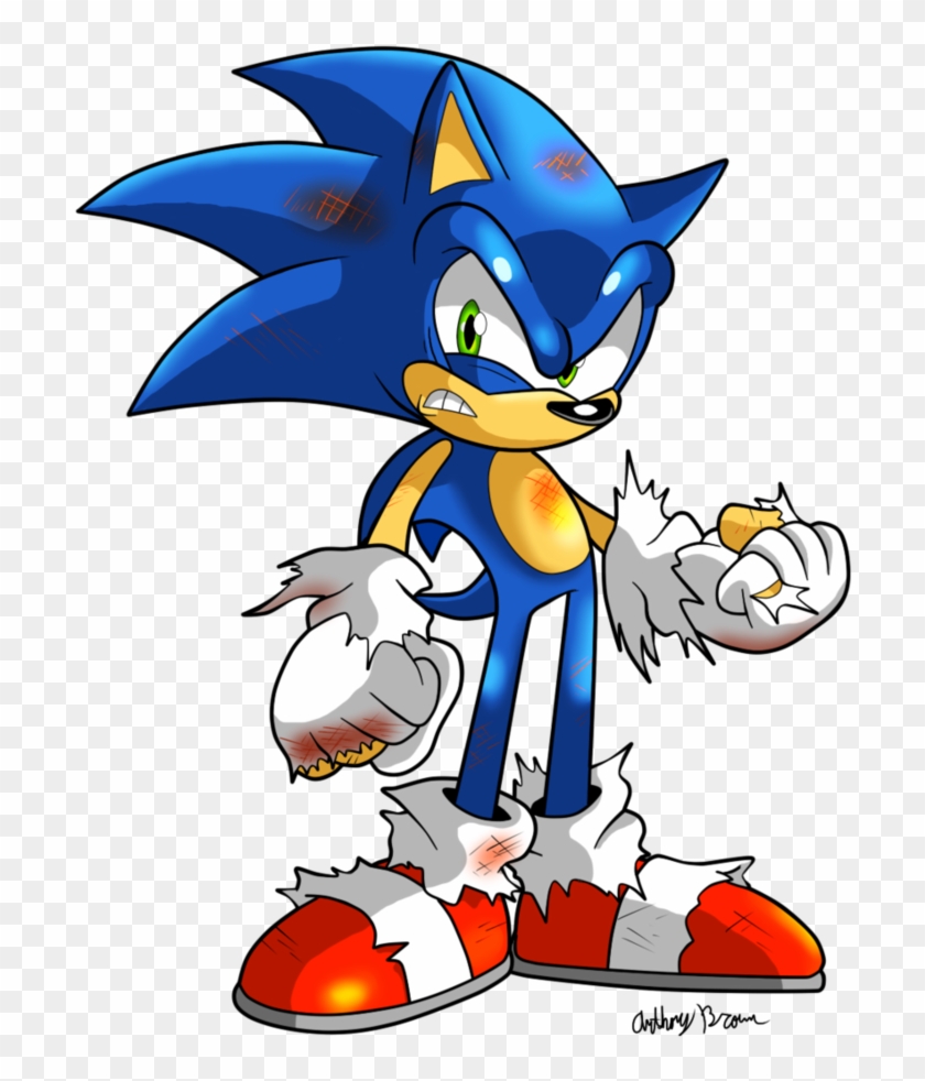 Hedgehog Clipart Mean - Beaten Up Sonic #325965