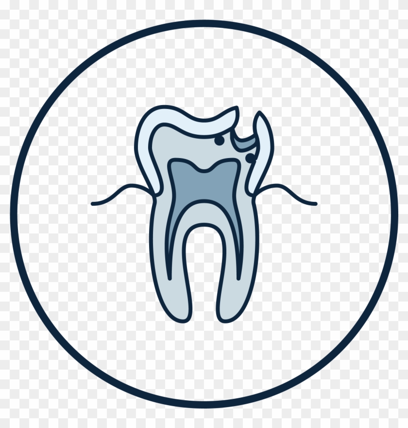 Root Canal Treatment - Dentistry #331150