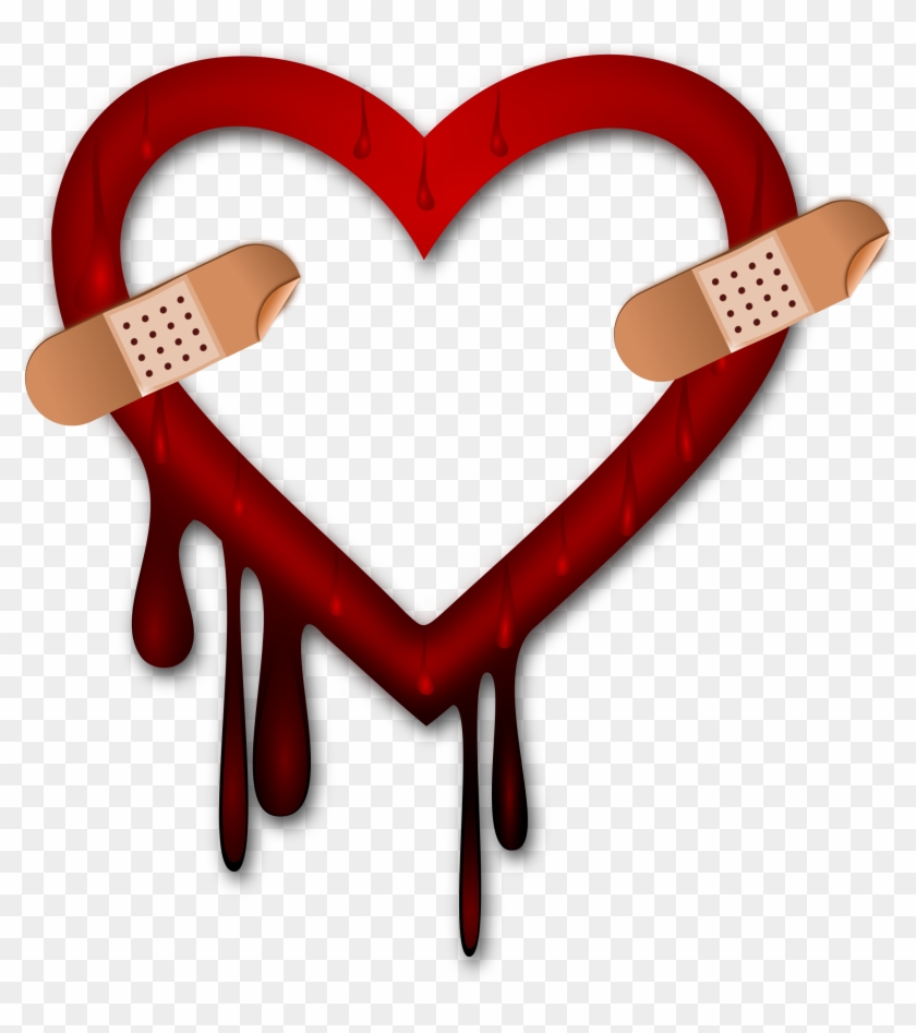 Heart Bleed Patch - Heartbleed #379347