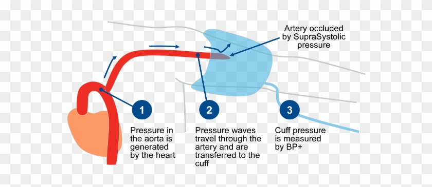 Bp Central Blood Pressure Trans - Central Blood Pressure Measurement #403703