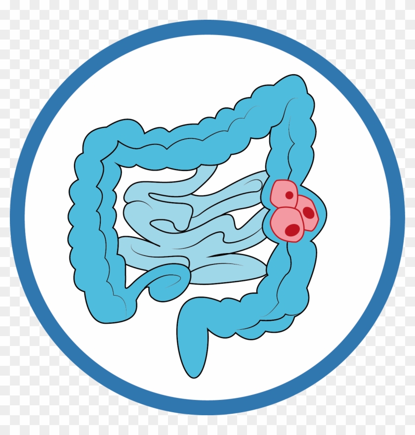 Filtre Spécialité Le Dépistage Du Cancer Colorectal - Screening #414064